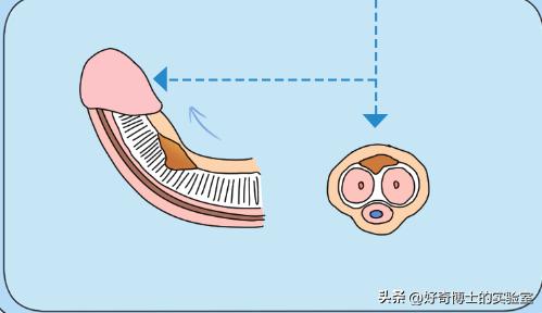 男生丁丁变歪是身体出了什么问题吗？影不影响*生活性**？