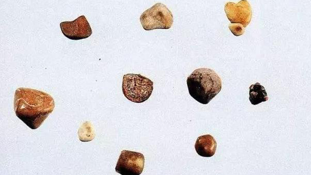 速效救心丸治什么心脏病,速效救心丸可以用于各种心脏病吗