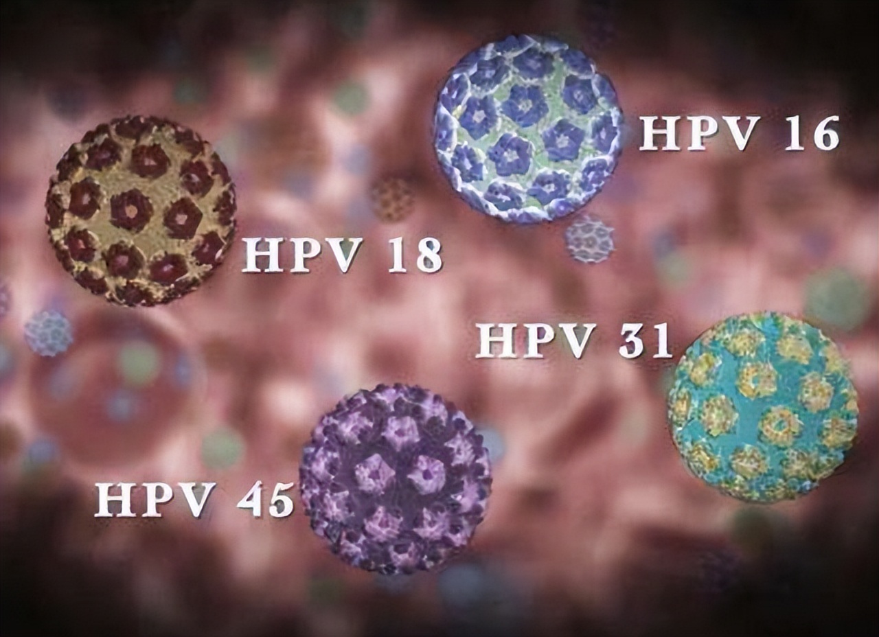 日本hpv疫苗严重事件,日本女性为什么不愿意接种hpv疫苗