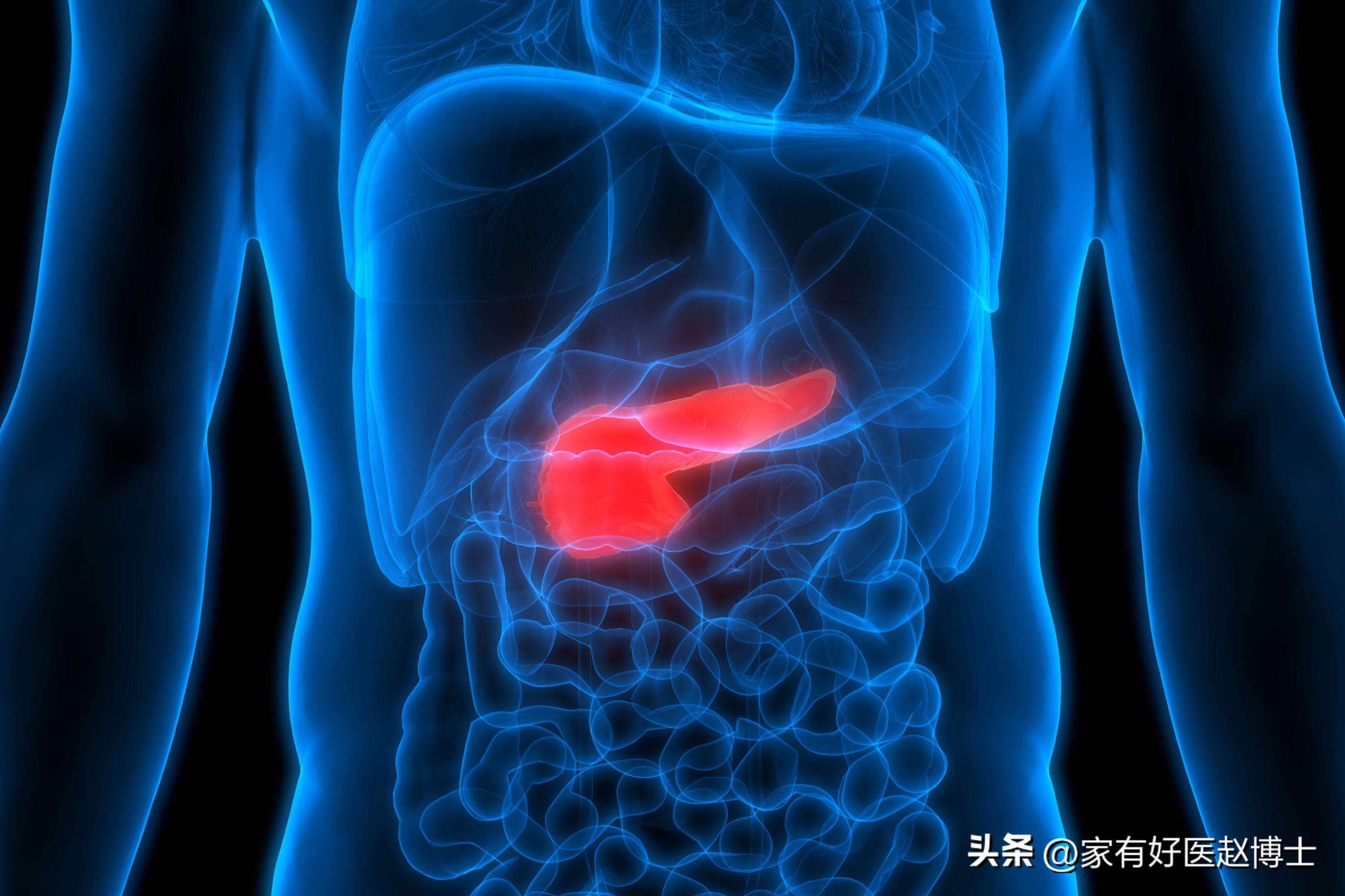 查出血糖高为什么控糖后更高,发现血糖升高一个月要吃药吗