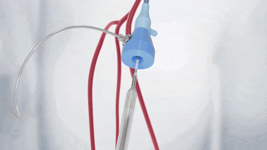 世界首个人工心脏,人工心脏最新突破