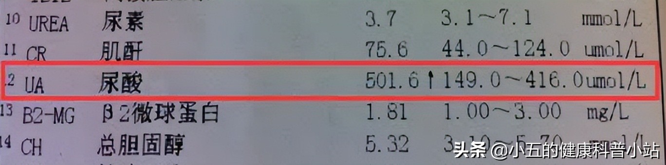 非布司他是防治痛风的常用药，可以长期服用，但需要注意这4点