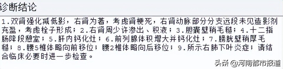 听说过心梗脑梗吗,心梗和脑梗的几大信号