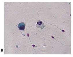 4000万精子“赛跑”，只有一颗胜出，失败的最后都去哪了？