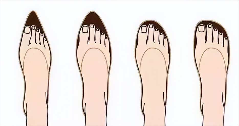 拇外翻的5种解决方法,拇外翻做什么动作缓解