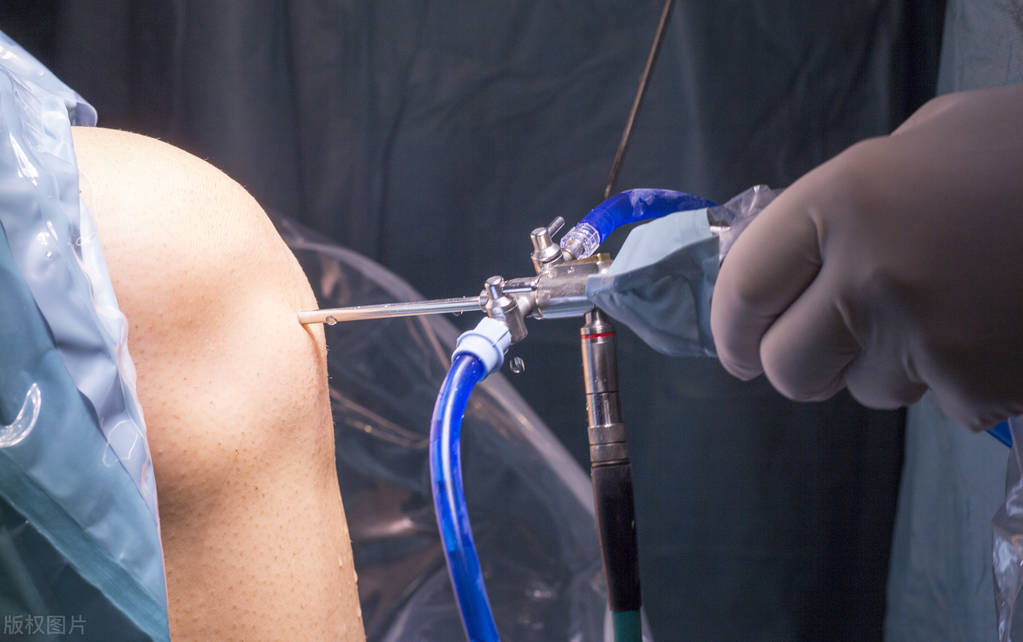 踢球膝盖扭伤长时间恢复不了,踢球大腿正面拉伤要休息多久