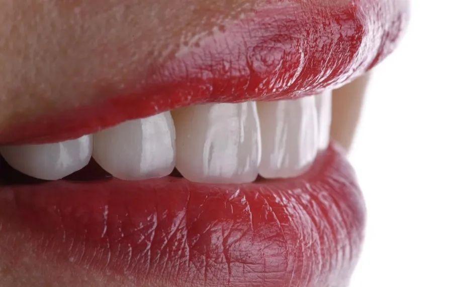 牙齿贴面什么材质经济又耐用,牙齿瓷贴面哪家做的好