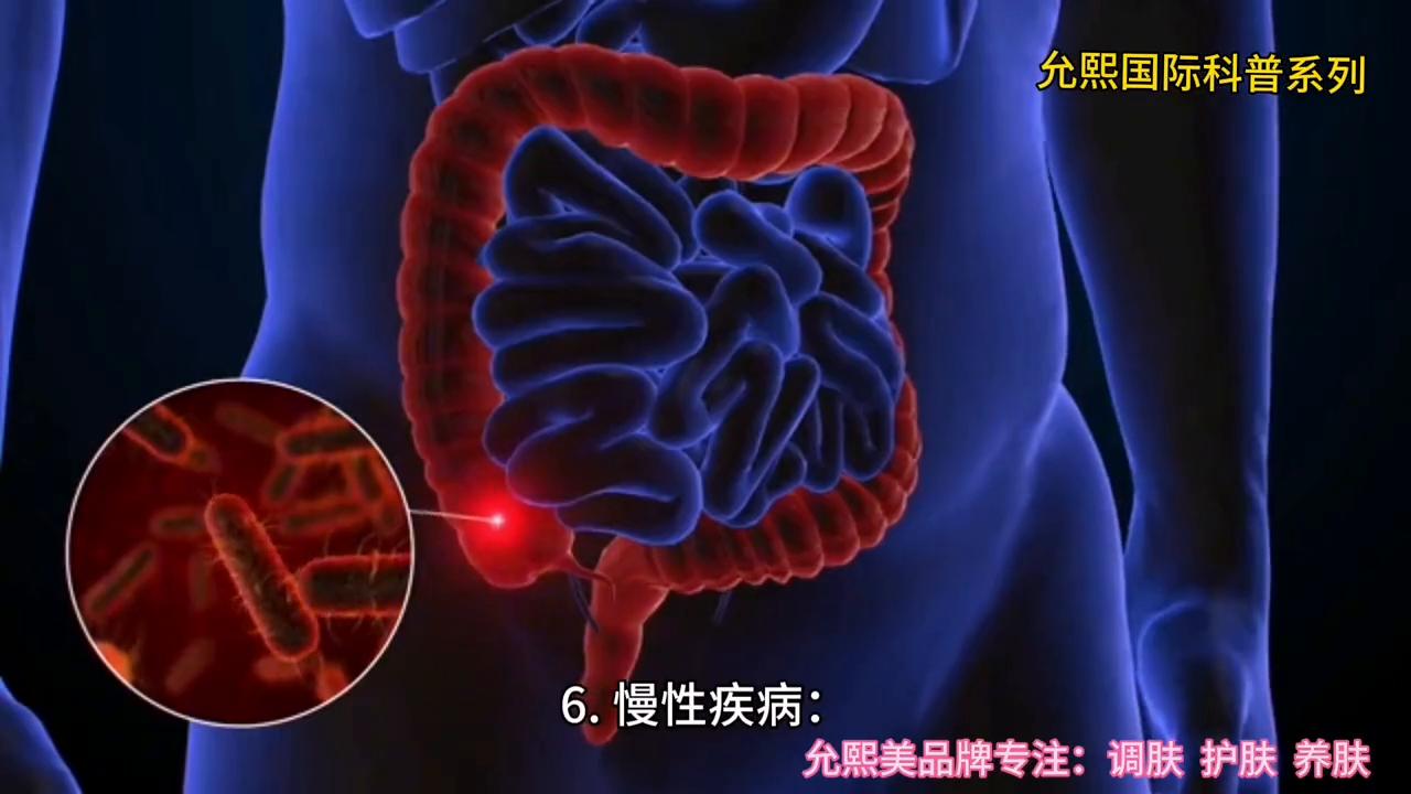 【允熙美】女性脸上的斑是怎么形成的？