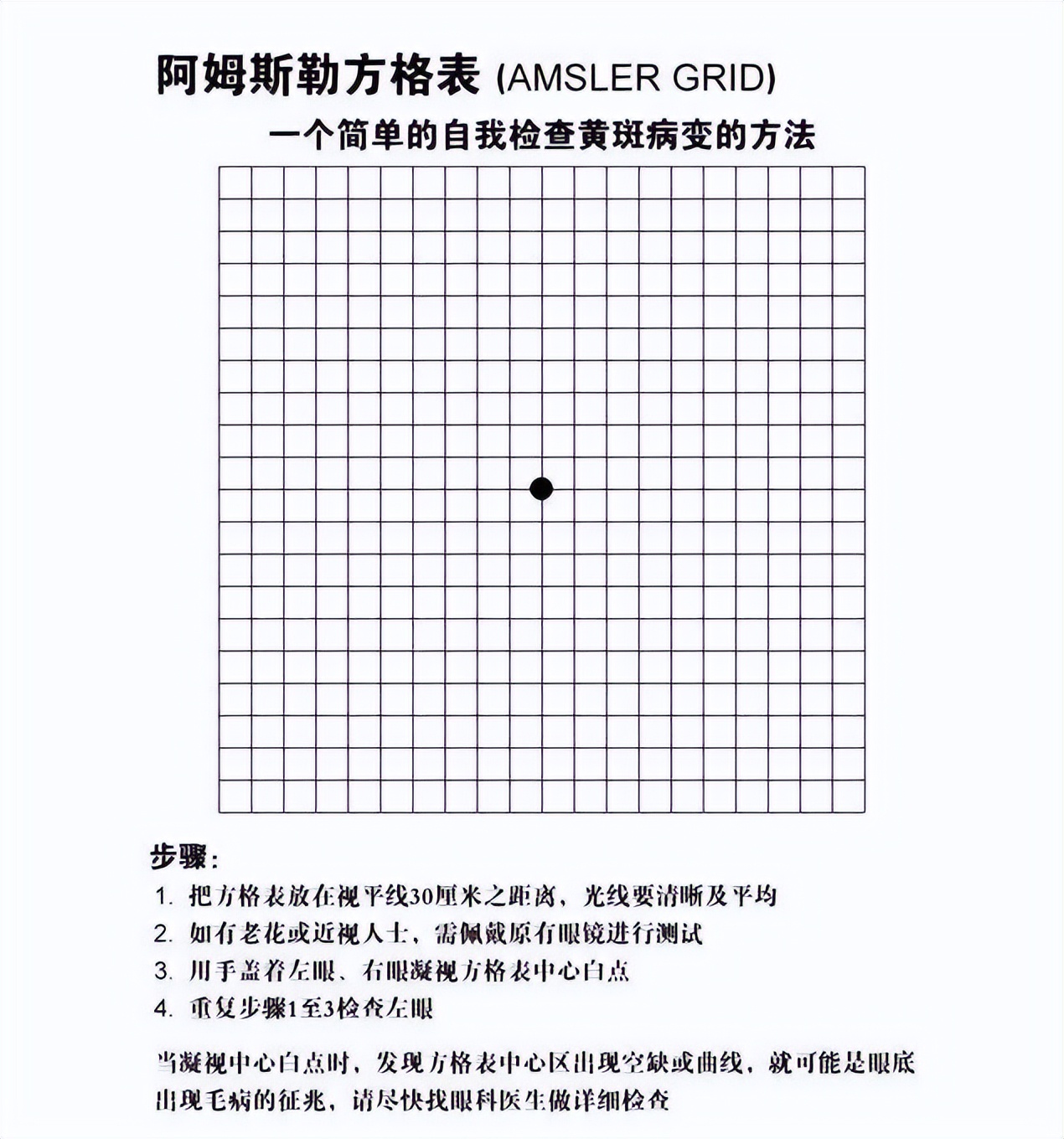 眼睛黄斑的治疗和饮食,眼科知识大全黄斑病变