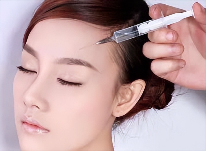 打玻尿酸变美的案例,额头玻尿酸1-7天恢复过程图