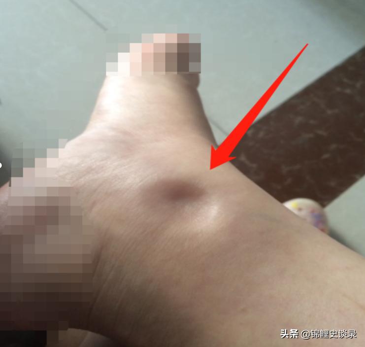 罕见260斤孕妇安徽,260斤巨婴孕妇