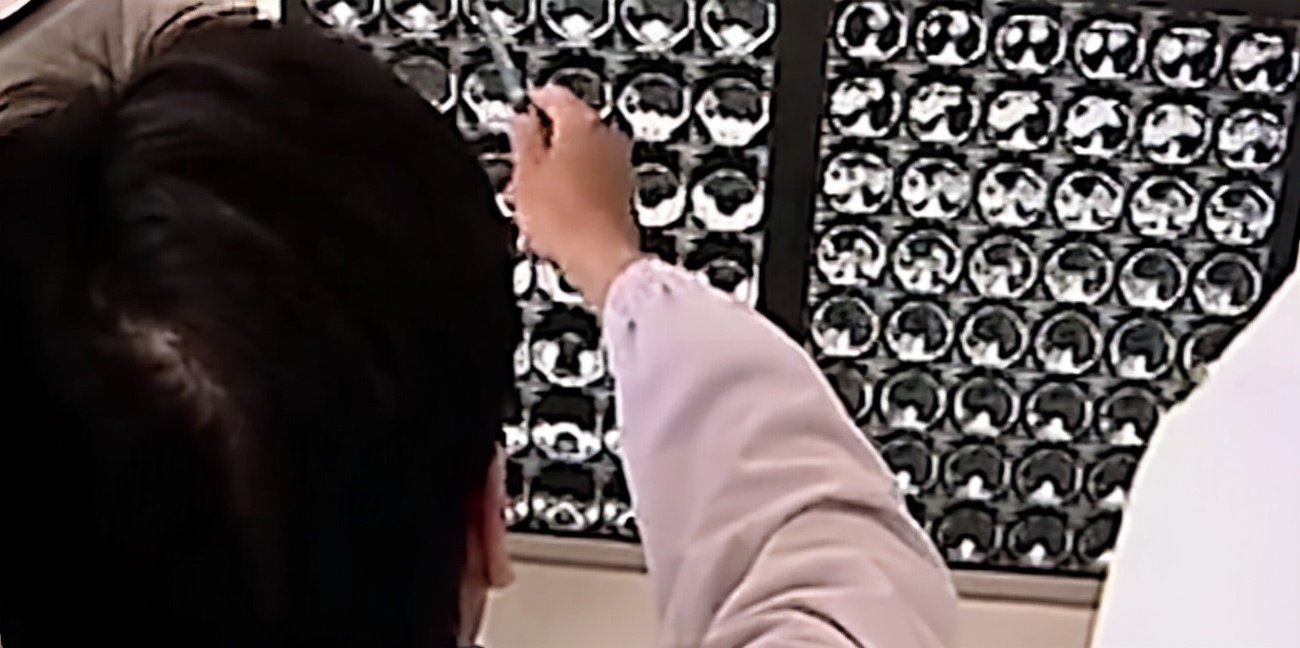 老人去医院检查五脏六腑离奇消失,50岁大爷五脏六腑离奇消失