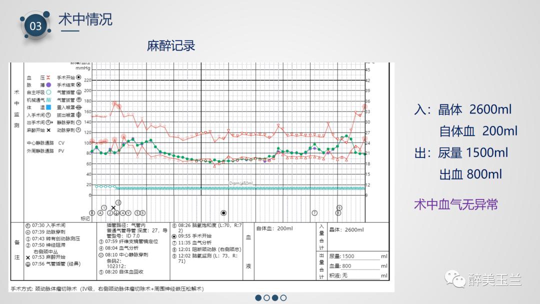 颈动脉体瘤切除术患者的麻醉管理,PPT课件