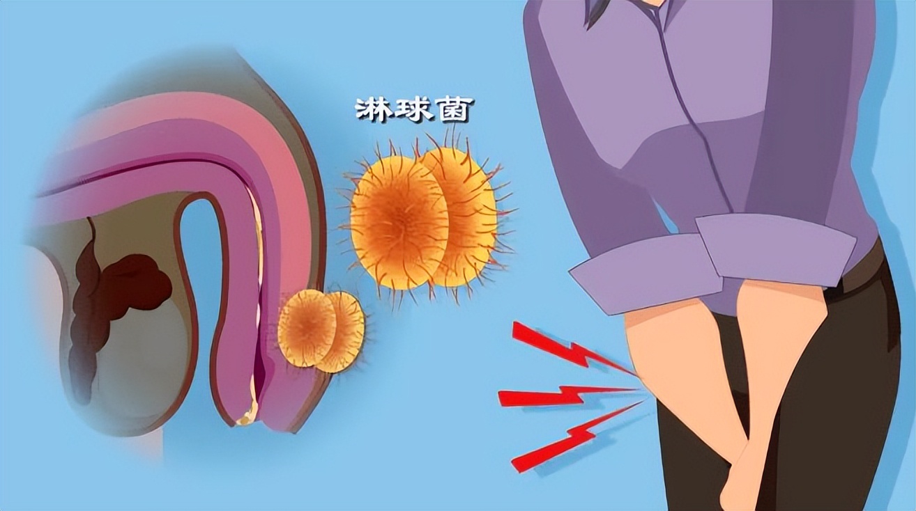 八种性传播疾病及病原体,8种性传播的疾病有哪些