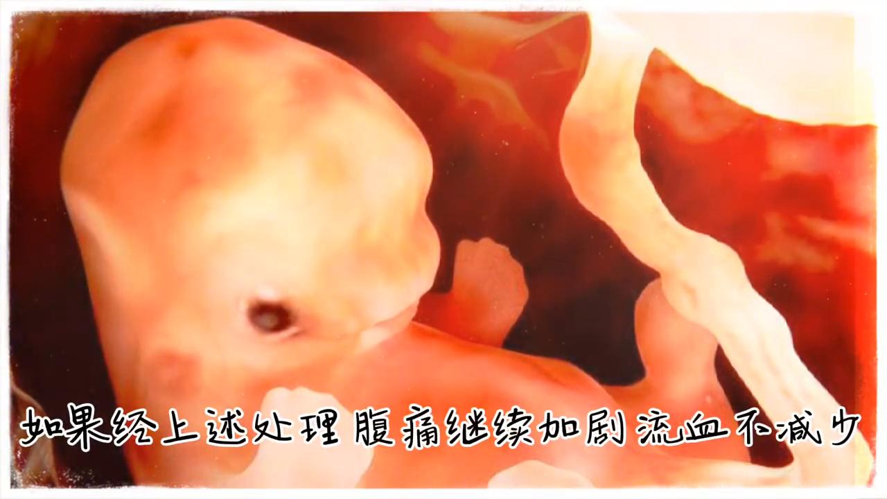 孕期出血怎么办#育儿经验分享