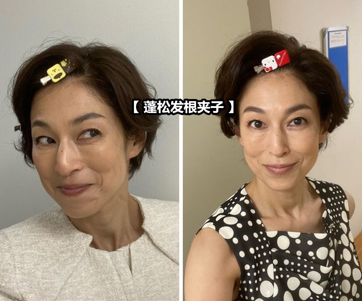 短发比长发好看的女星,盘点4位女星短发造型