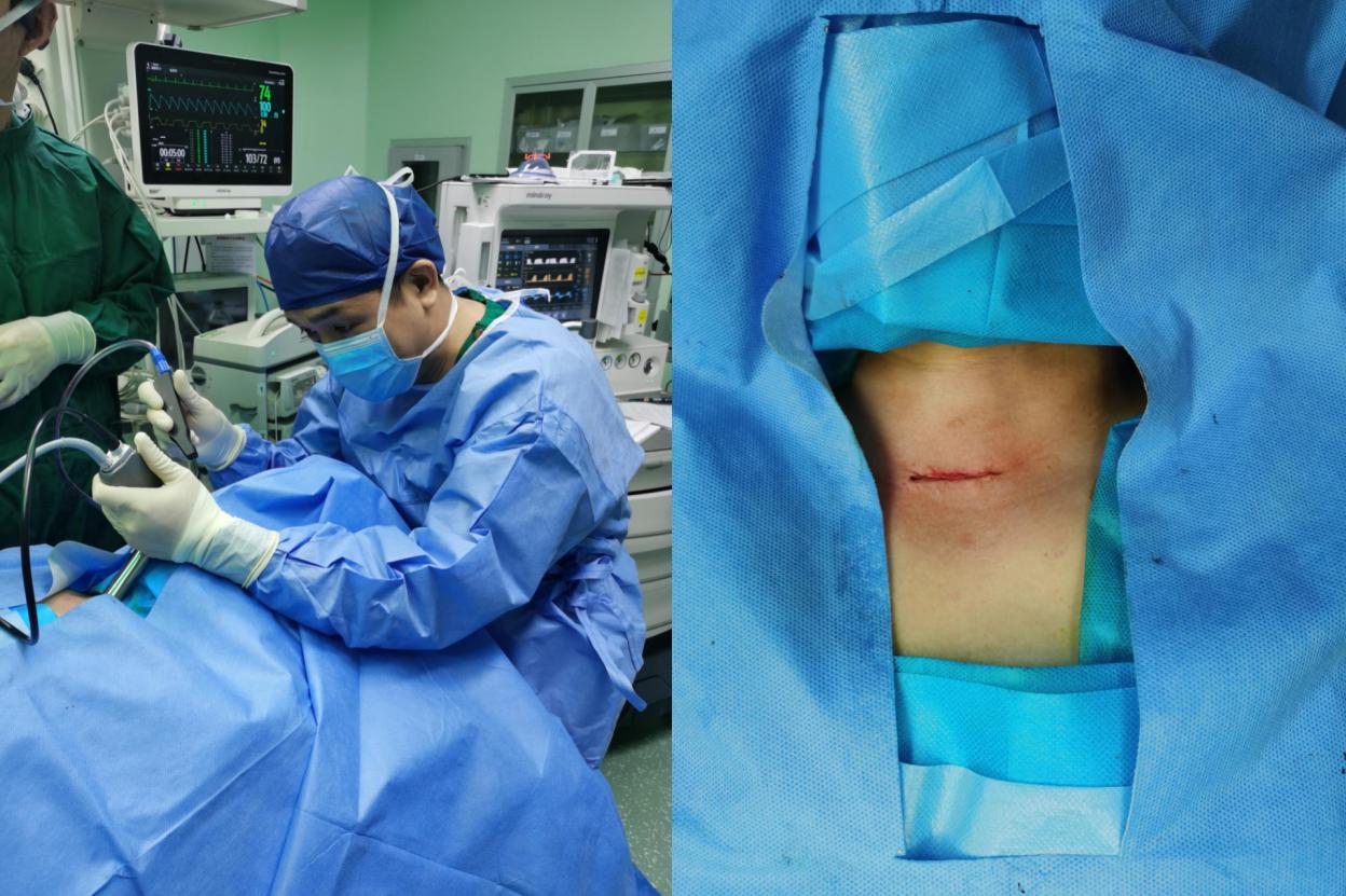 杨弘中山大学肿瘤,杨弘医生怎么样