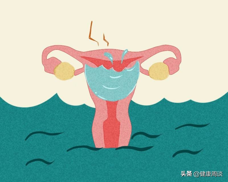女性总是潮湿瘙痒是怎么回事,女性潮湿瘙痒是什么原因造成的