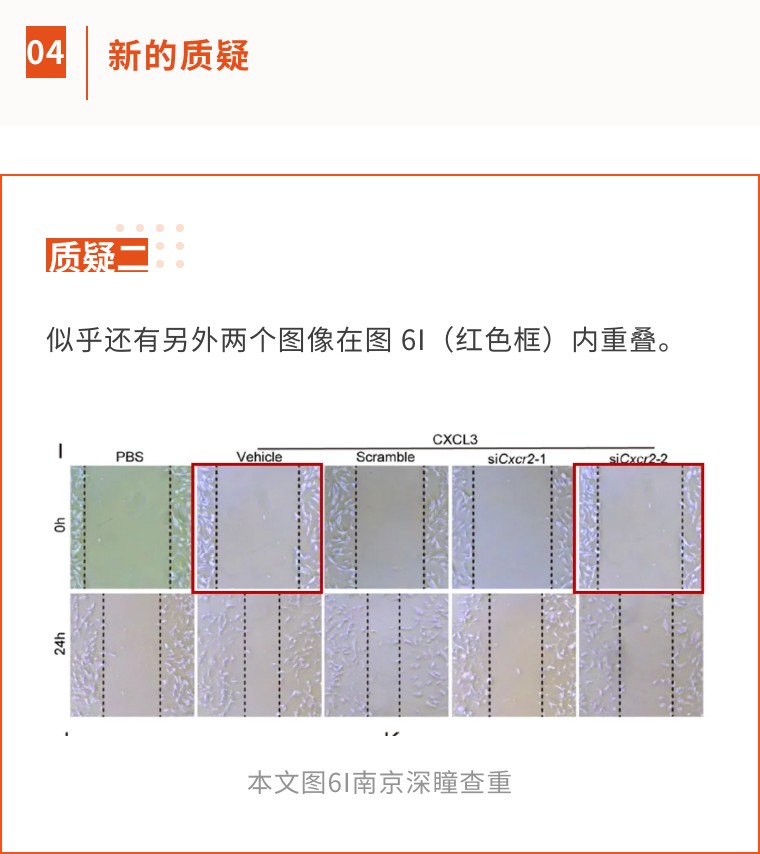 上海曙光医院发表的超高分一区论文被质疑，因存在多处图片问题