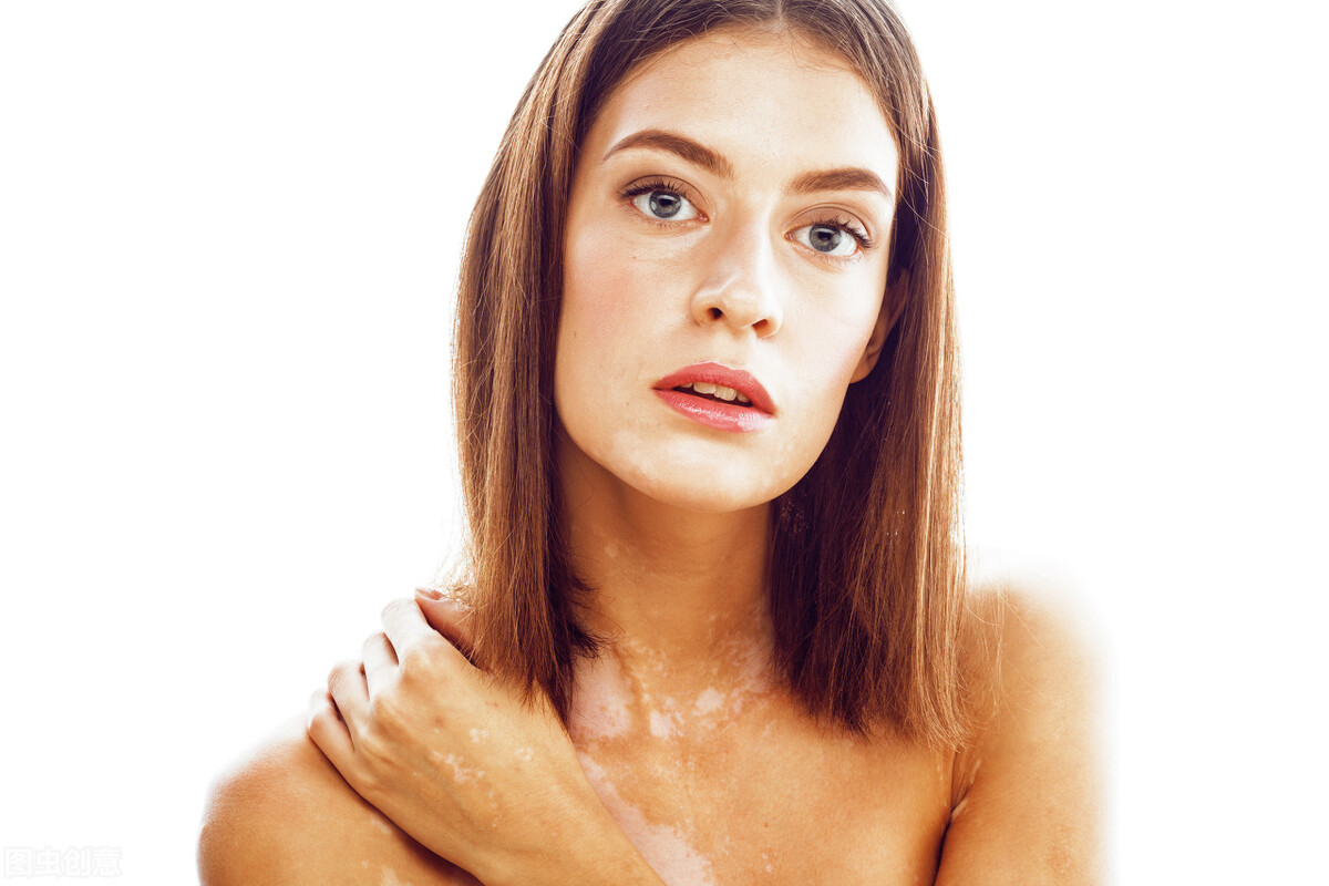 胳膊上的白癜风用什么药,胳膊上有白癜风可以治好吗