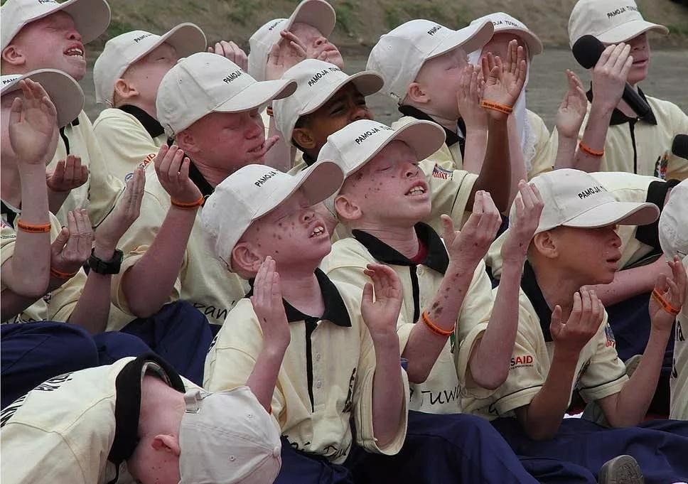 非洲最特殊的人群：血液堪比黄金，遗骸卖上百万，却无法健康成长