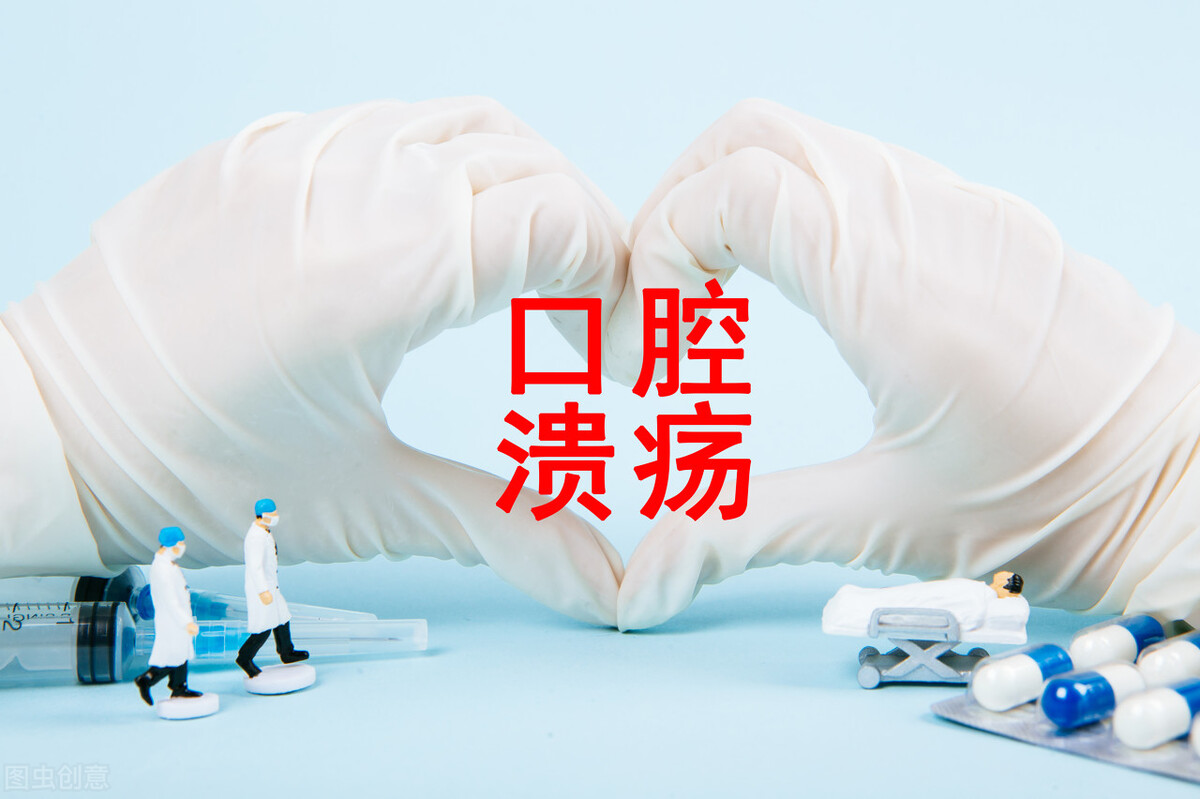 口腔溃疡发病机制诊断及诊疗指南,5种口腔溃疡