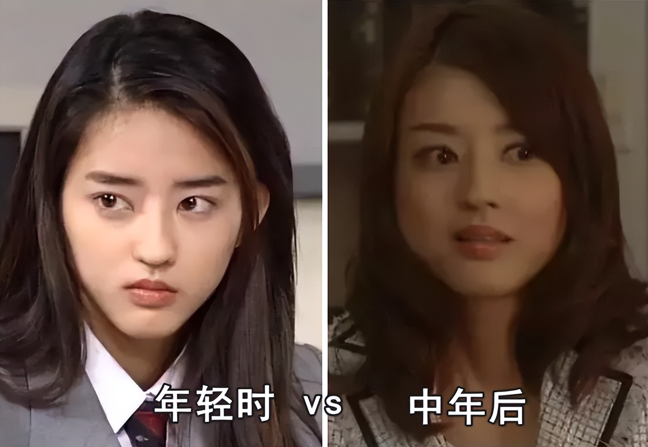 发腮和塌腮哪个更显老,发腮真的显老吗