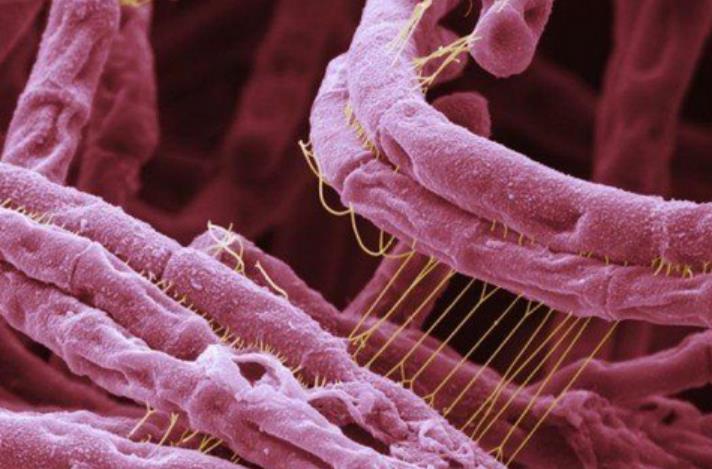 世界上最致命的病毒九种,细菌和病毒哪个更致命