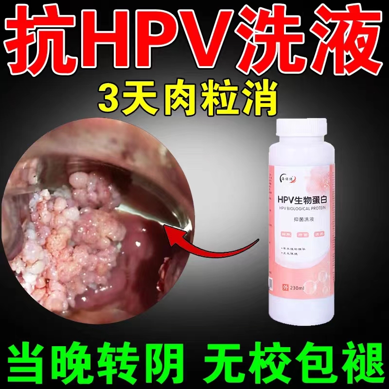 购物车内有这几样东西的请撤销，都是智商税。