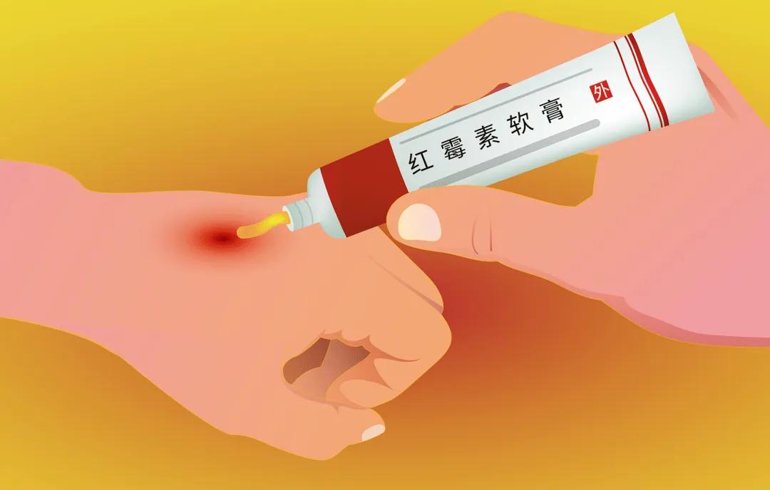 红霉素软膏涂眼部底下有什么效果,眼部周围很干可以用红霉素软膏