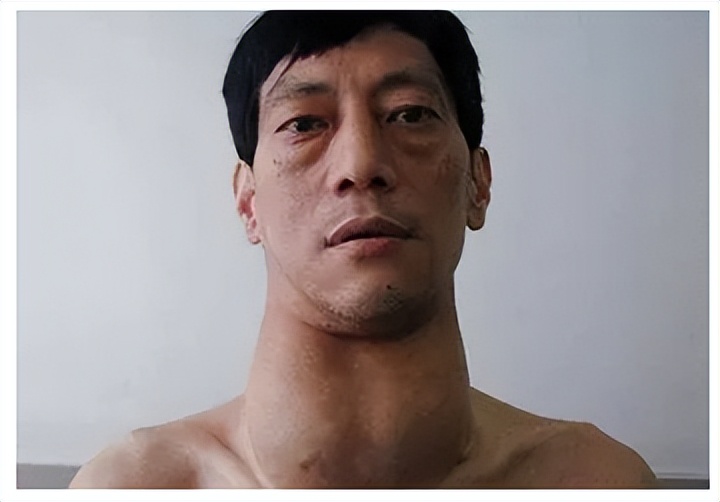 每天学习一种药｜碘131（同位素碘131的内放射治疗）