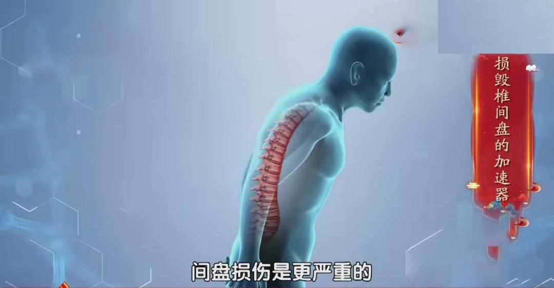 脊柱病三个动作自愈方法,椎间盘突出可以做脊柱屈的动作吗