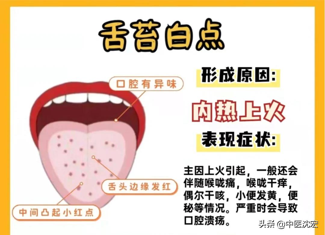 中医教你看舌头得知身体表现,中医看舌头舌苔图谱
