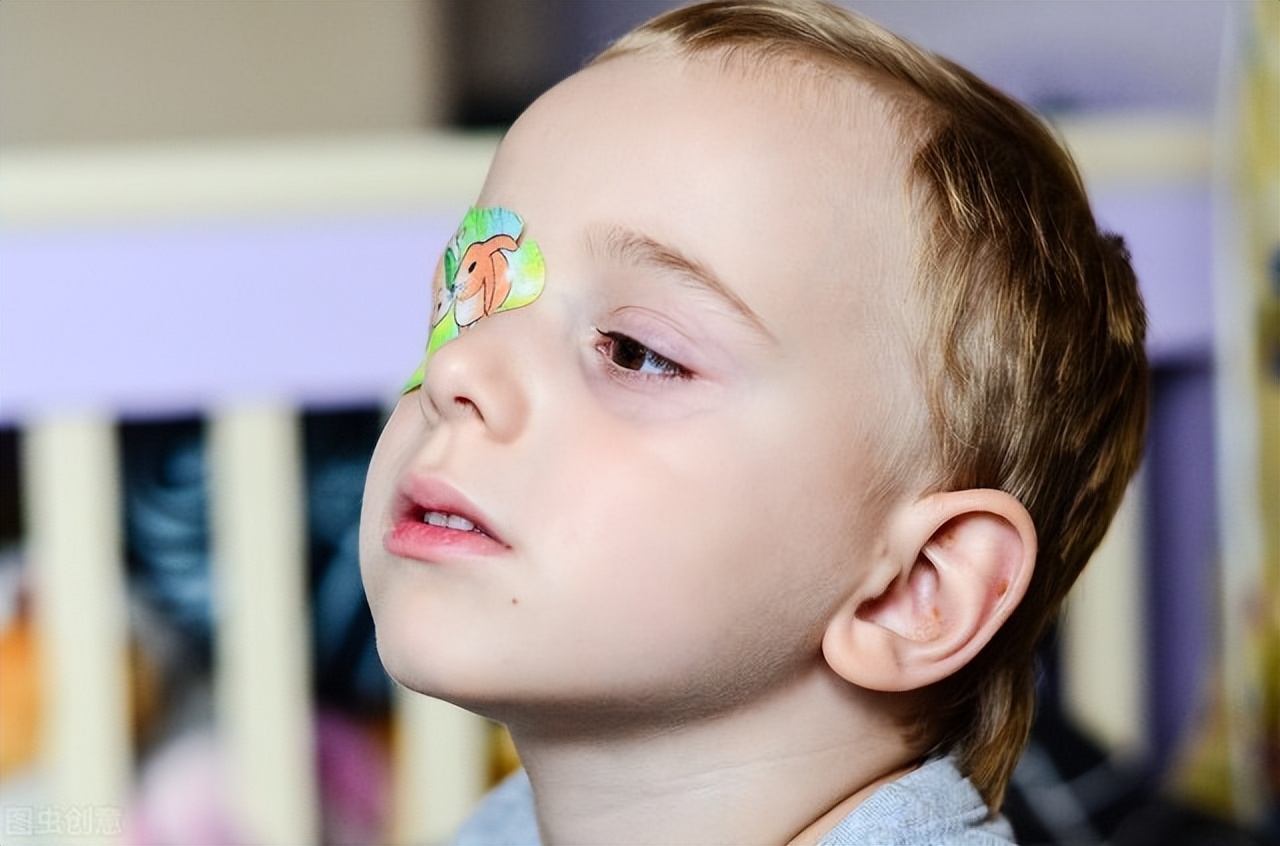 斜视性弱视的配镜原则,弱视的遮盖原则和方法