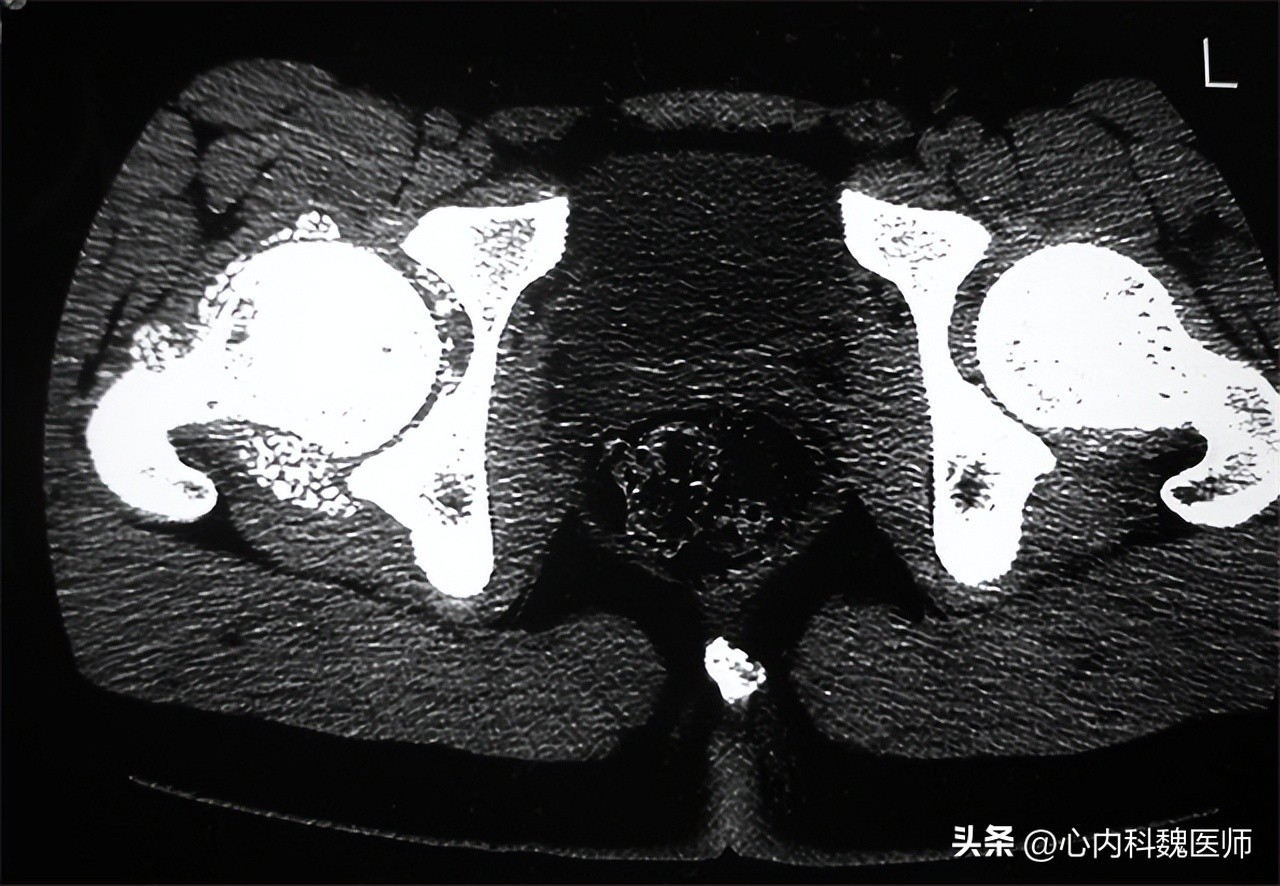 身体有病胯骨知道,身体有多处问题怎么看医生