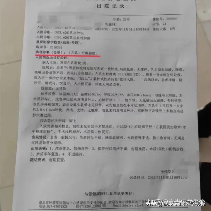 乳腺超声病例,乳腺肿块巨大超声结果4a