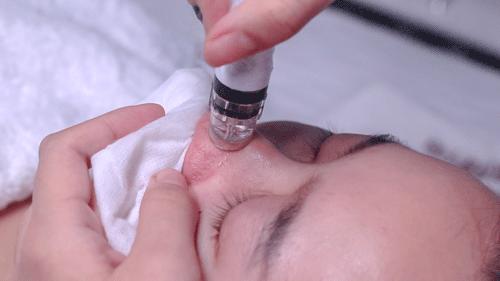 超微小气泡美容有用吗,美容院小气泡