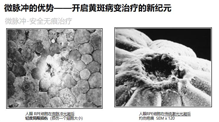 眼底激光治疗仪,577眼底激光