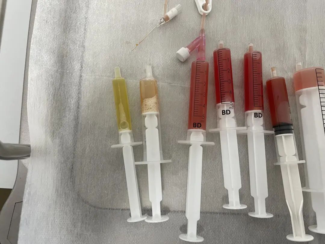 被大厂裁员后去环球影城,被大厂裁员后心态调整