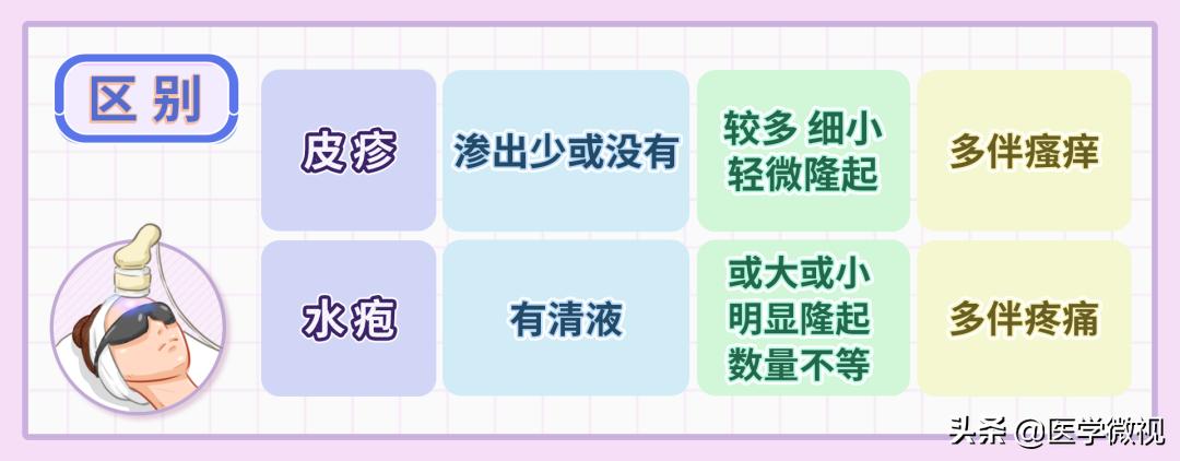 光子嫩肤结痂后皮肤脱皮泛白,光子嫩肤后脱皮