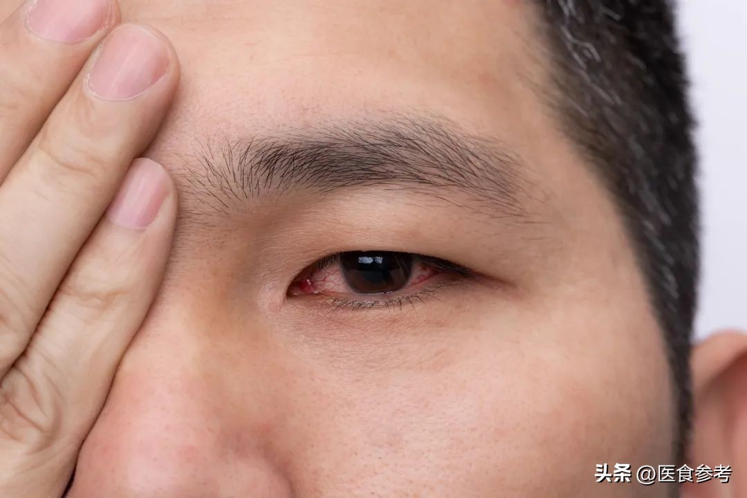 眼皮跳是什么预兆和疾病,眼皮跳的预兆非常准哦