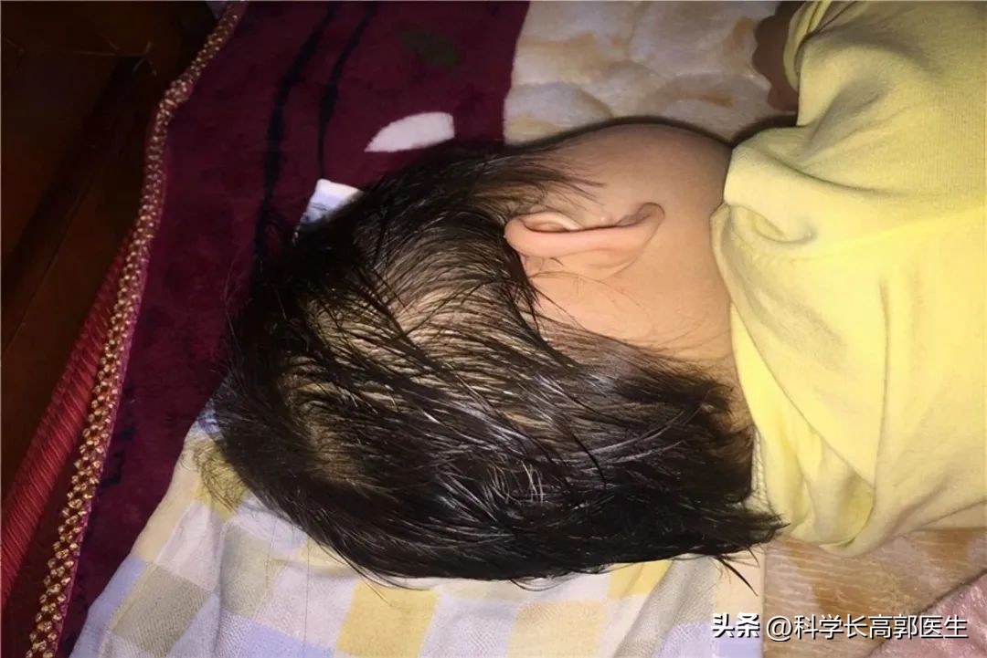 小孩咳嗽反复发烧有什么好方法,孩子咳嗽反复发烧怎么办最有效