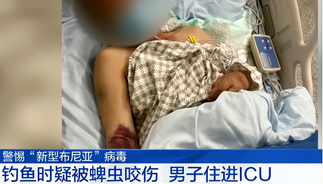 夏季常见蚊虫叮咬图鉴,女孩被家人吸血10年