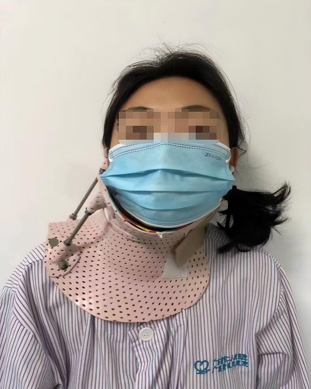 脖子歪睡觉能扶正吗,歪头多久可以矫正