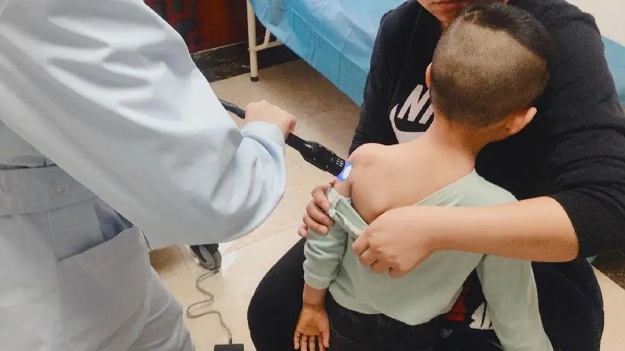 儿童白癜风光疗后好转又复发,白癜风308光疗以后为什么更严重