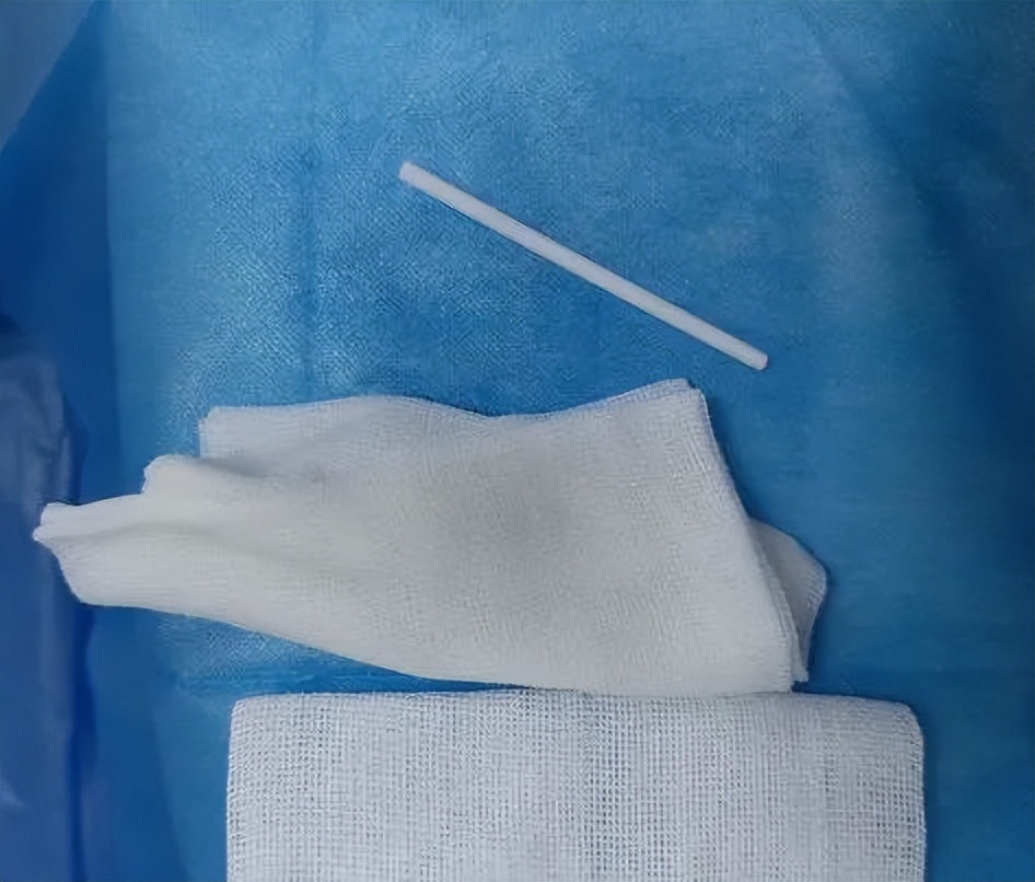 小孩误吞棒棒糖塑料杆怎么检查,小孩误吞棒棒糖塑料棍