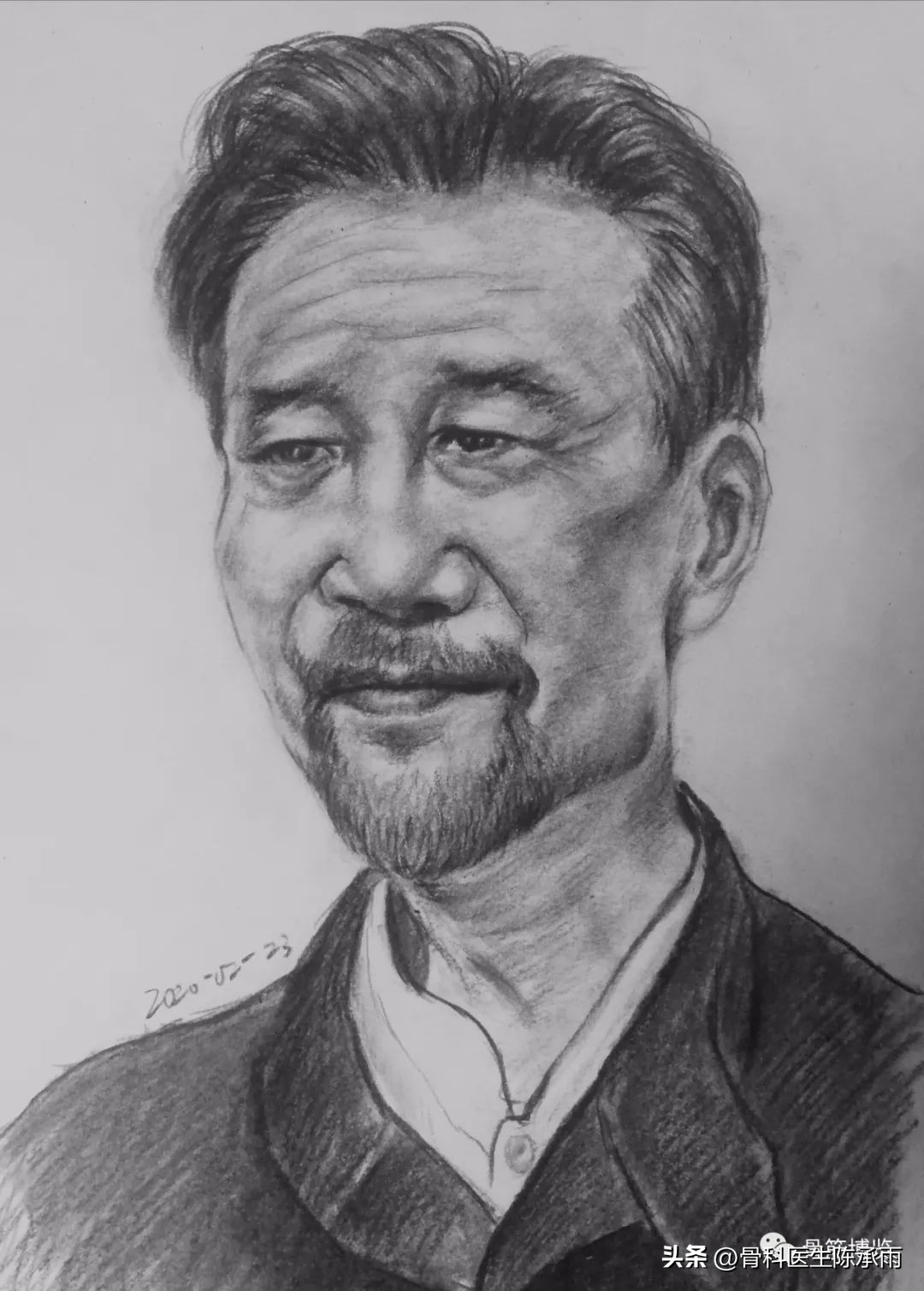 膝关节胫骨平台骨折,最近胫骨平台骨折视频