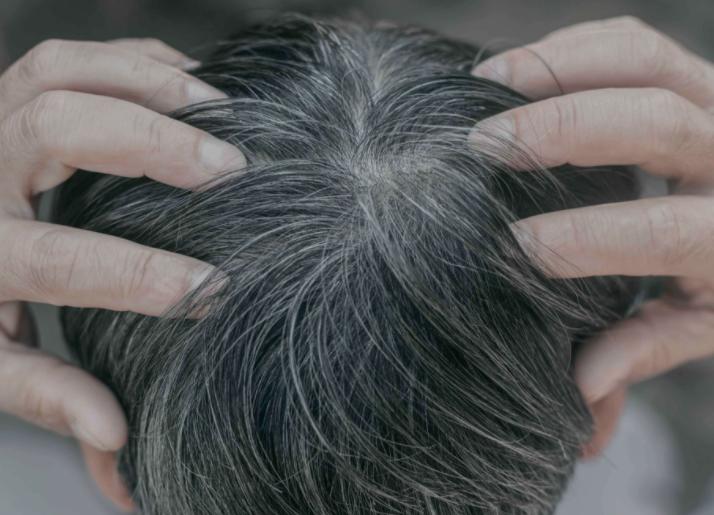 年轻白头发是缺少什么营养,年轻人白头发是一般营养不足吗