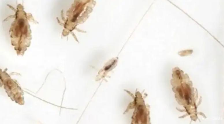 虱子现在灭绝了吗,虱子在自然界存在吗