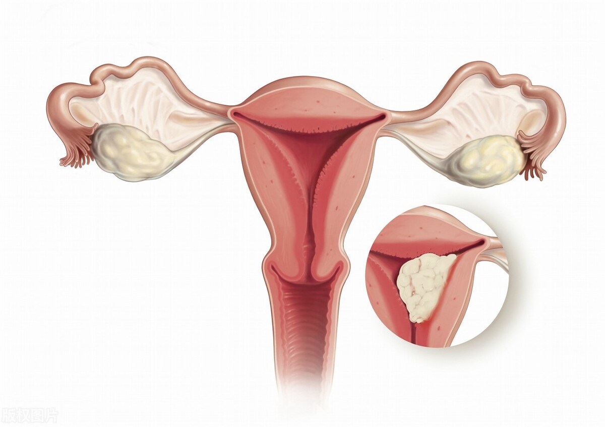 女人倒开花是什么病,老年人绝经后倒开花的三种表现